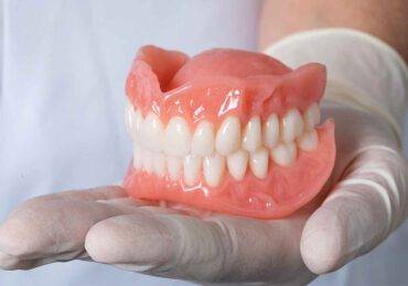 Complete Dentures